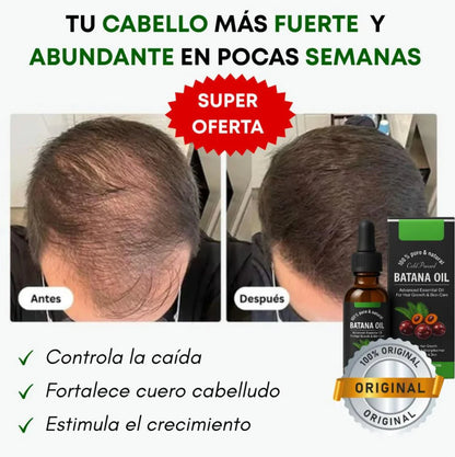 ACEITE DE BATANA