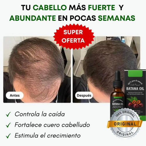 ACEITE DE BATANA