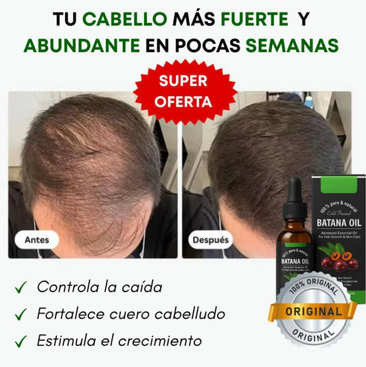 ACEITE DE BATANA
