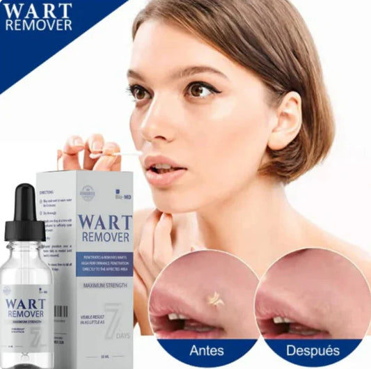 WART REMOVEDOR: Removedor de arrugas y lunares
