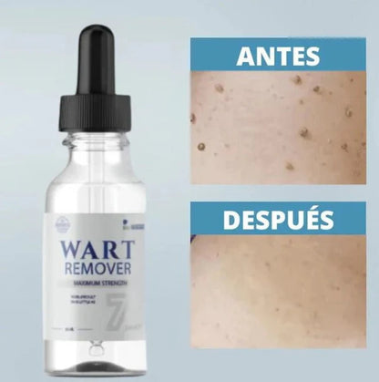 WART REMOVEDOR: Removedor de arrugas y lunares