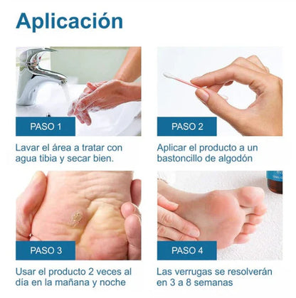 WART REMOVEDOR: Removedor de arrugas y lunares