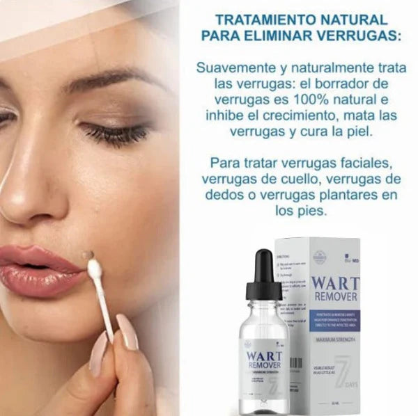 WART REMOVEDOR: Removedor de arrugas y lunares